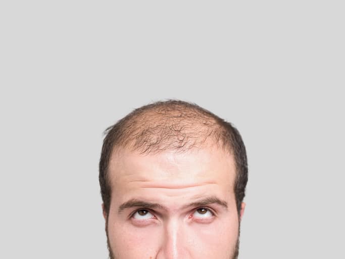 Mann mit Glatze, der die Augen nach oben rollt